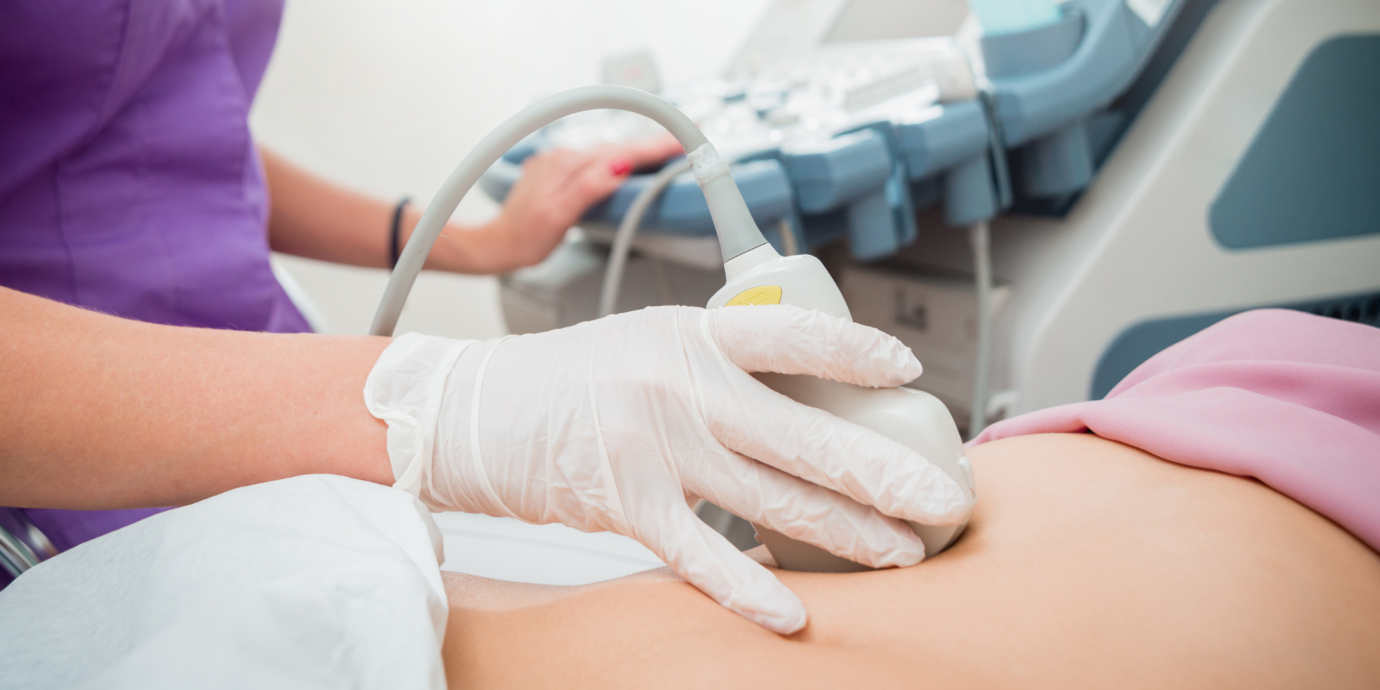 woman getting an ultrasound